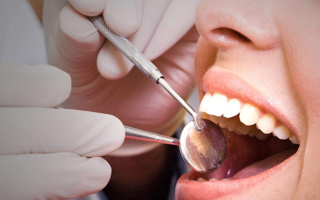 Limpieza Bucodental